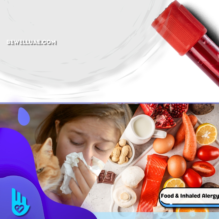 Comprehensive Allergy Profile